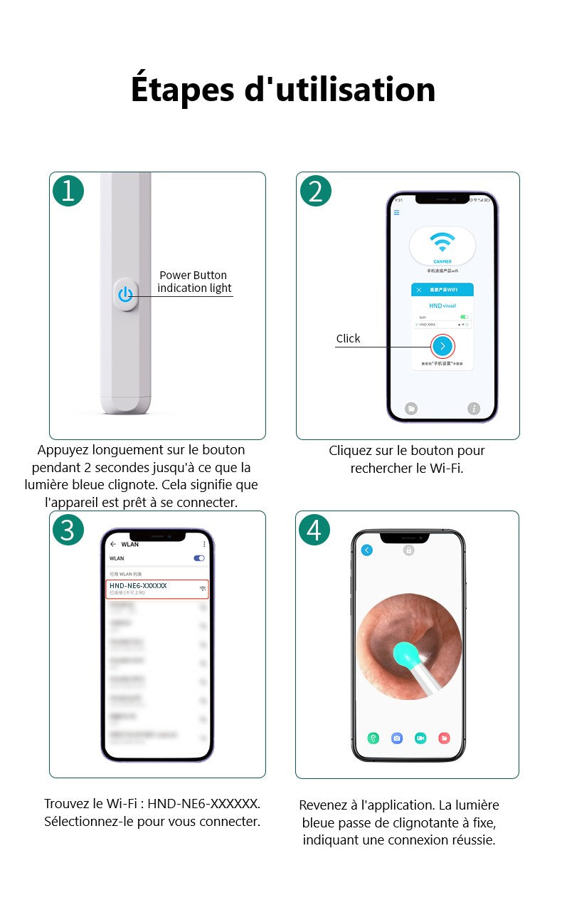 Otoscope Oreille 1080P HD WiFi Nettoyage Oreille