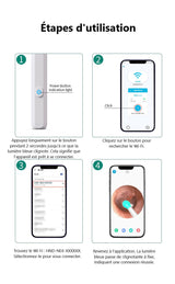 1080P HD WiFi Ear Otoscope Ear Cleaning