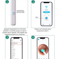 Otoscope Oreille 1080P HD WiFi Nettoyage Oreille